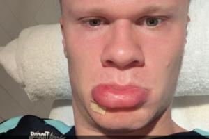 开云APP-盛世美颜哈兰德早起撅香肠嘴晒自拍：早上好